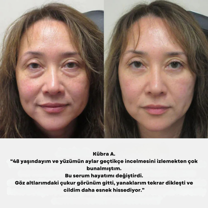 Gaena Kore Volufiline Kolajen Serumu