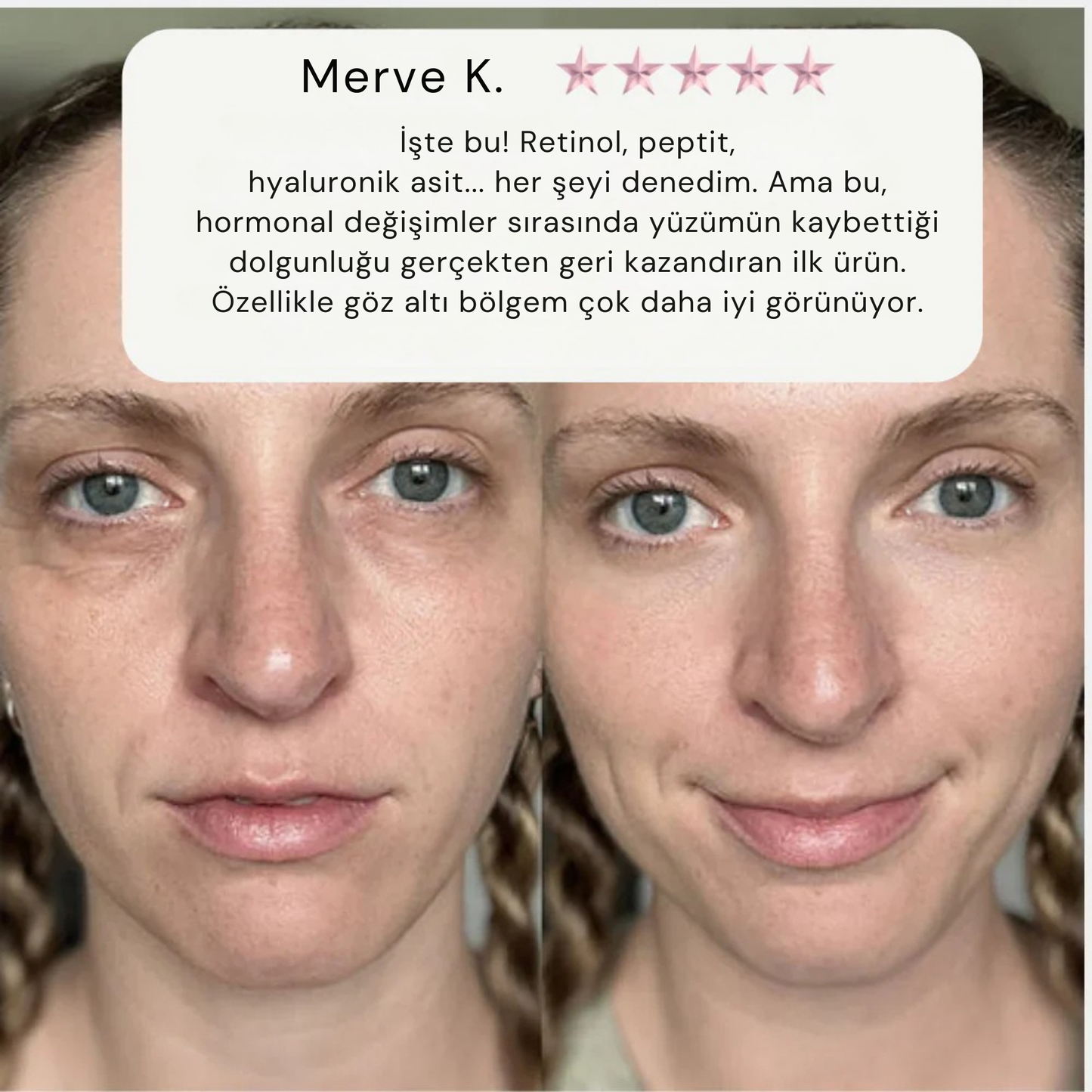 Gaena Kore Volufiline Kolajen Serumu